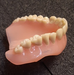 Yläkokoproteesi jossa 16 hammasta